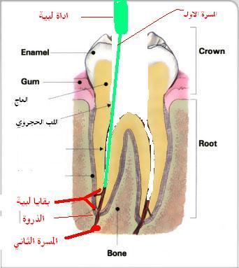post-28560-1246401544_thumb.jpg